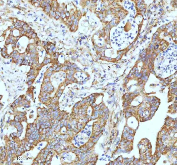 2 - Anti-GCLM Rabbit Monoclonal Antibody ABO16299