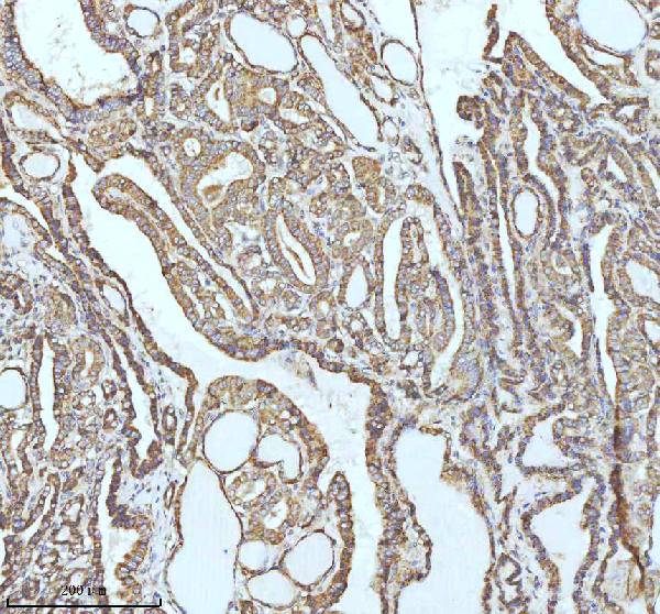 2 - Anti-GCLM Rabbit Monoclonal Antibody ABO16299