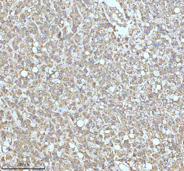2 - Anti-GCLM Rabbit Monoclonal Antibody ABO16299