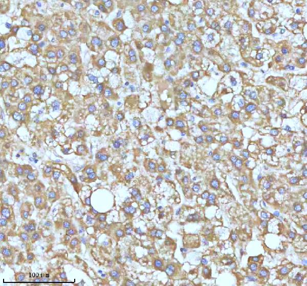 2 - Anti-GCLM Rabbit Monoclonal Antibody ABO16299