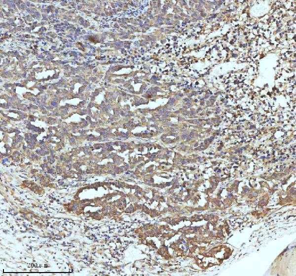 2 - Anti-GCLM Rabbit Monoclonal Antibody ABO16299