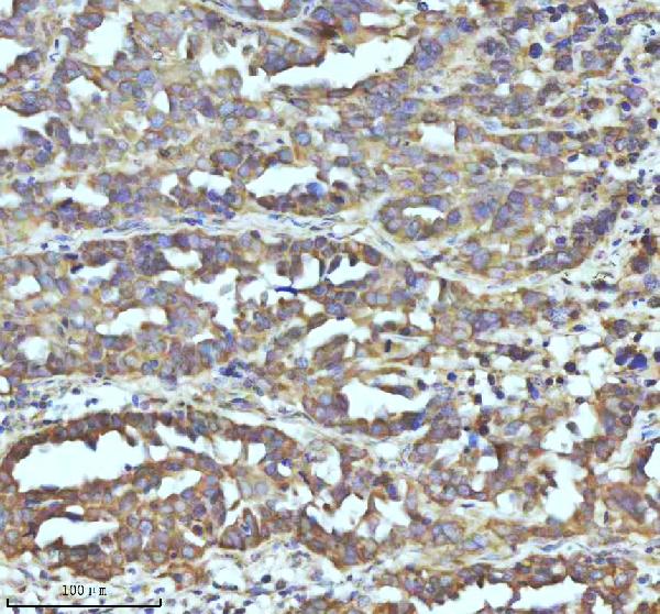 2 - Anti-GCLM Rabbit Monoclonal Antibody ABO16299