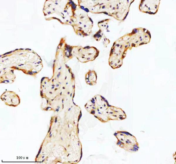2 - Anti-GCLM Rabbit Monoclonal Antibody ABO16299