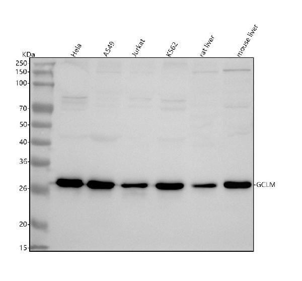 1 - Anti-GCLM Rabbit Monoclonal Antibody ABO16299