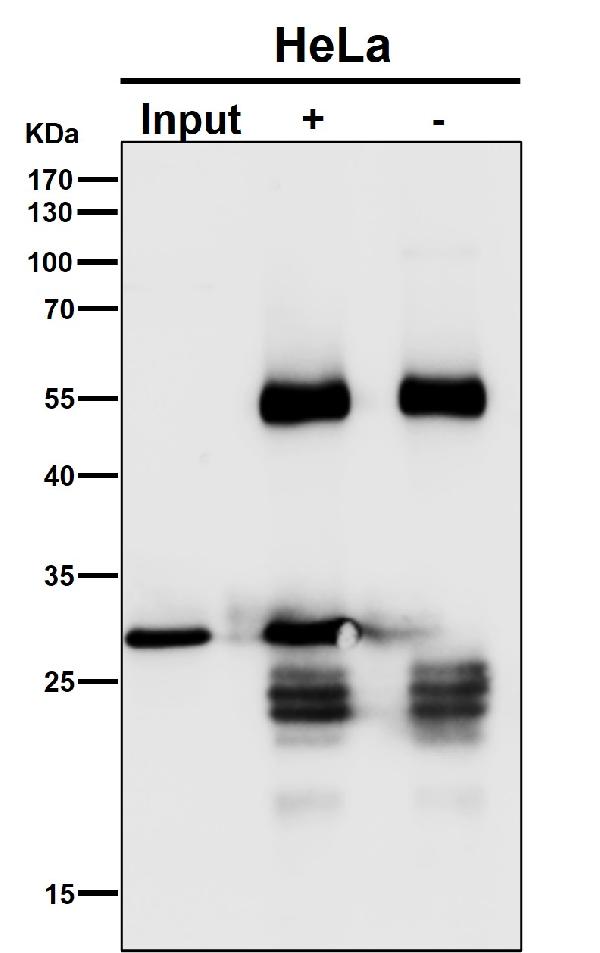 1 - Anti-GCLM Rabbit Monoclonal Antibody ABO16299