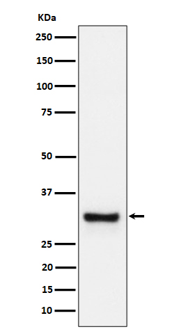 1 - Anti-Adiponectin Rabbit Monoclonal Antibody ABO16300