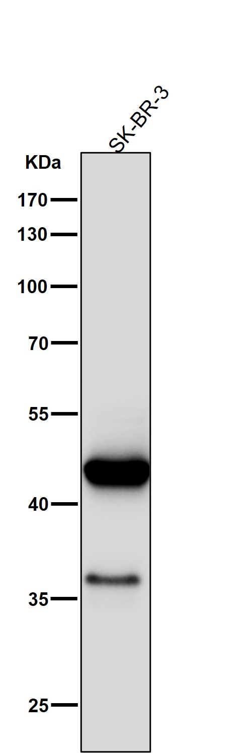 1 - Anti-Cytokeratin 19 Rabbit Monoclonal Antibody ABO16301