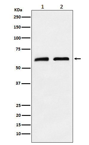 1 - Anti-CLPX Rabbit Monoclonal Antibody ABO16302