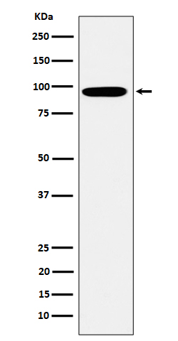 1 - Anti-Epsin 1 Rabbit Monoclonal Antibody ABO16303