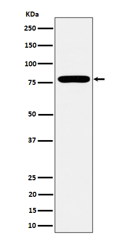 1 - Anti-GFPT1 Rabbit Monoclonal Antibody ABO16304
