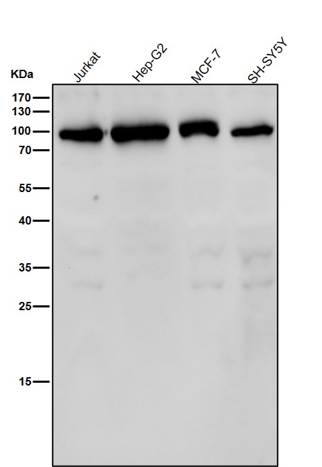 1 - Anti-GFPT1 Rabbit Monoclonal Antibody ABO16304