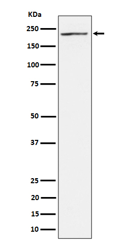 1 - Anti-MAP3K4 Rabbit Monoclonal Antibody ABO16305
