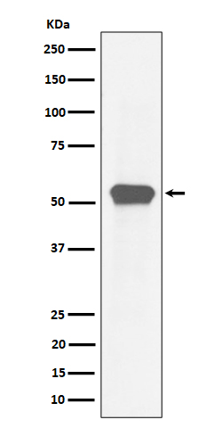 1 - Anti-MEF2A Rabbit Monoclonal Antibody ABO16308