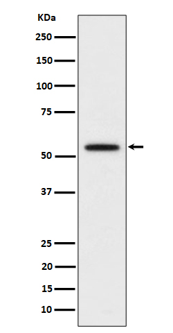 1 - Anti-p60 katanin Rabbit Monoclonal Antibody ABO16309
