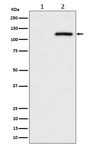 1 - Anti-Phospho-CBL (S669) Rabbit Monoclonal Antibody ABO16310