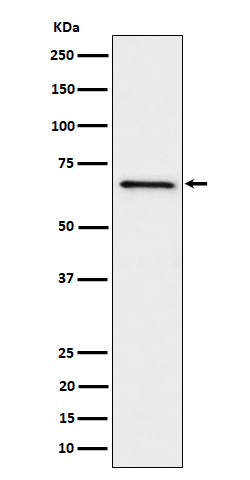 1 - Anti-GRK6 Rabbit Monoclonal Antibody ABO16311