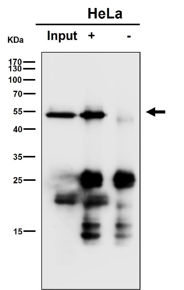1 - Anti-GRSF1 Rabbit Monoclonal Antibody ABO16315