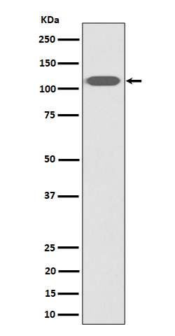 1 - Anti-ZHX2 Rabbit Monoclonal Antibody ABO16316