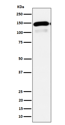 1 - Anti-PLCB1 Rabbit Monoclonal Antibody ABO16318