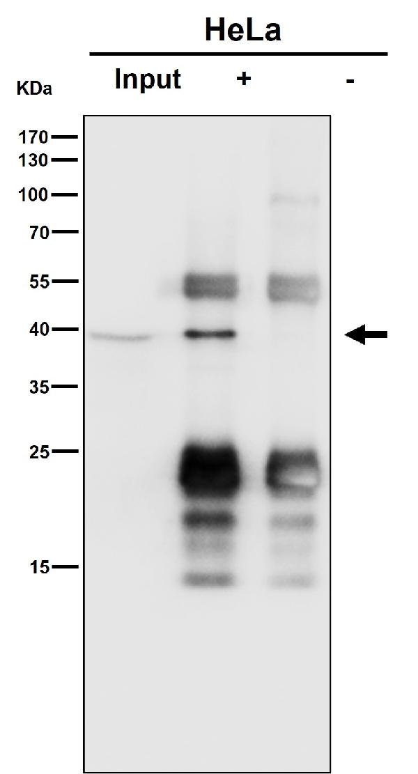 1 - Anti-SLP2 Rabbit Monoclonal Antibody ABO16320