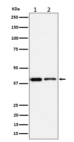 1 - Anti-SLP2 Rabbit Monoclonal Antibody ABO16320