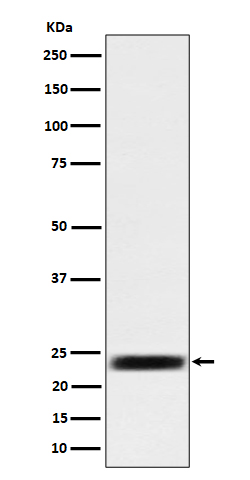 1 - Anti-ARFRP1 / ARP Rabbit Monoclonal Antibody ABO16321