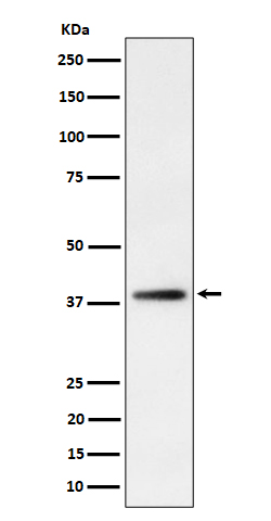 1 - Anti-FDPS Rabbit Monoclonal Antibody ABO16322