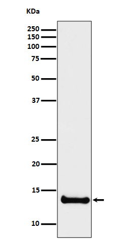 1 - Anti-Cystatin B Rabbit Monoclonal Antibody ABO16323