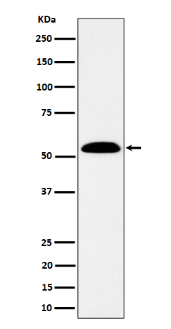 1 - Anti-ALDH7A1 Rabbit Monoclonal Antibody ABO16327