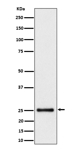 1 - Anti-HMG4 Rabbit Monoclonal Antibody ABO16328