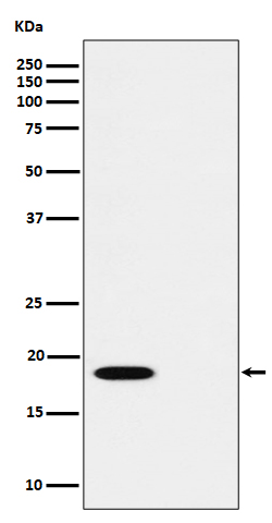 1 - Anti-Phospho-PTS (S19) Rabbit Monoclonal Antibody ABO16331