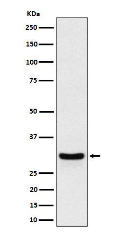 1 - Anti-FRAT1 Rabbit Monoclonal Antibody ABO16332
