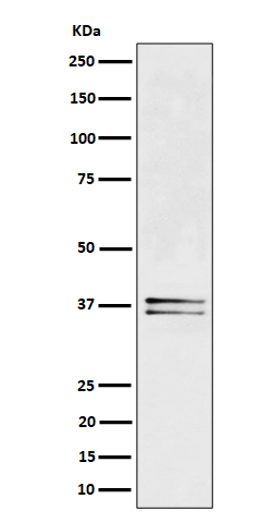 1 - Anti-LAT Rabbit Monoclonal Antibody ABO16336