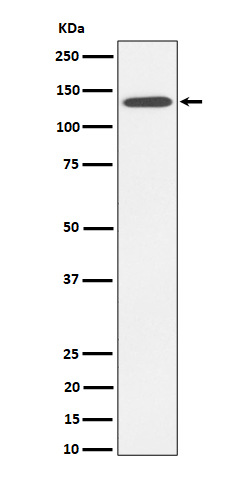 1 - Anti-R Cadherin Rabbit Monoclonal Antibody ABO16337