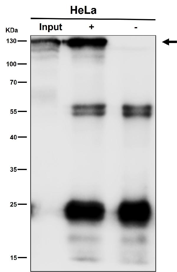 1 - Anti-Phospho-MCM2 (S108) Rabbit Monoclonal Antibody ABO16340