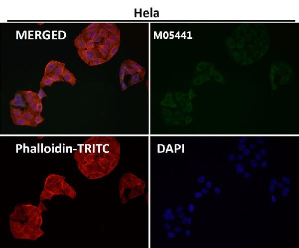 1 - Anti-ADX Rabbit Monoclonal Antibody ABO16344
