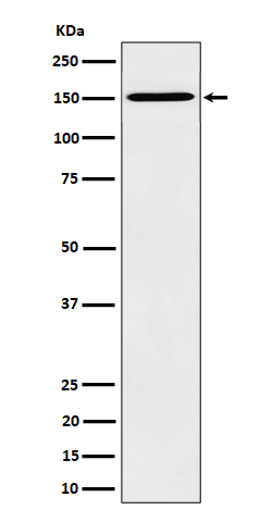 1 - Anti-HDLBP Rabbit Monoclonal Antibody ABO16345