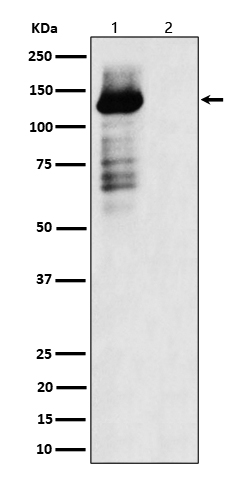 1 - Anti-Phospho-TAOK1/2/3 (S181 + S181 + S177) Rabbit Monoclonal Antibody ABO16346