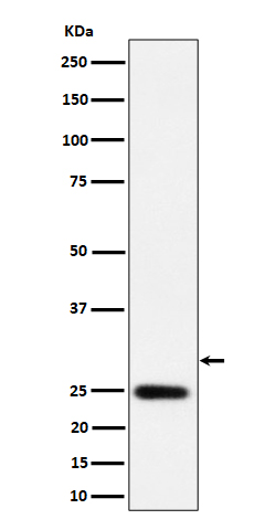 1 - Anti-NAT1 Rabbit Monoclonal Antibody ABO16348