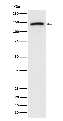 1 - Anti-Cadherin 10 Rabbit Monoclonal Antibody ABO16349