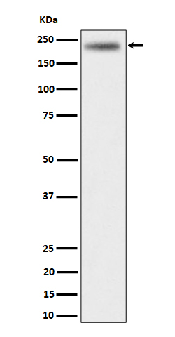 1 - Anti-DENN Rabbit Monoclonal Antibody ABO16350
