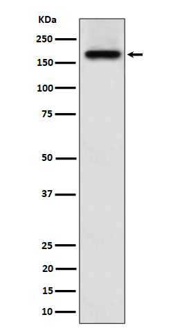 1 - Anti-SARA Rabbit Monoclonal Antibody ABO16353