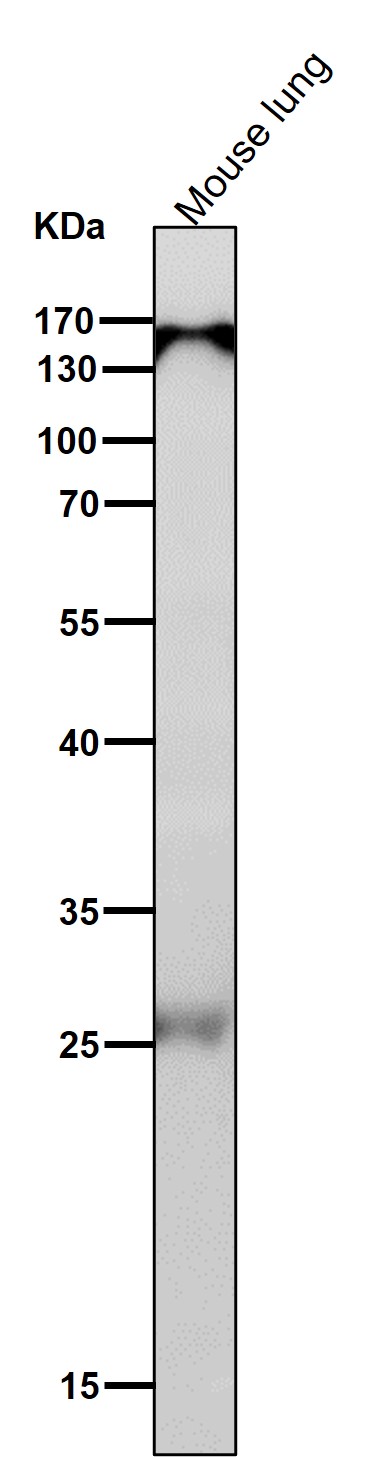 1 - Anti-Importin 9 / RANBP9 Rabbit Monoclonal Antibody ABO16354