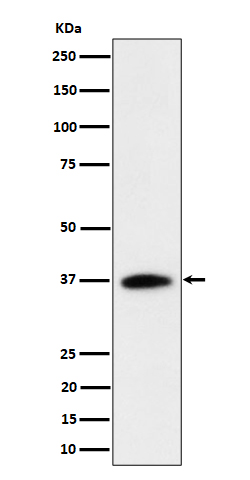 1 - Anti-RASSF2 Rabbit Monoclonal Antibody ABO16358
