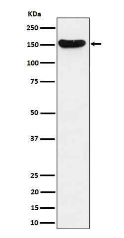 1 - Anti-HDLBP Rabbit Monoclonal Antibody ABO16359