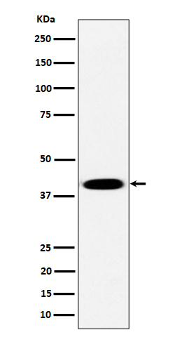 1 - Anti-Pleckstrin Rabbit Monoclonal Antibody ABO16360
