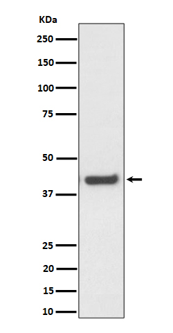 1 - Anti-MVK Rabbit Monoclonal Antibody ABO16361