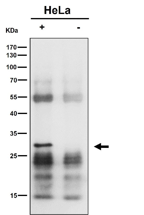 1 - Anti-MTAP Rabbit Monoclonal Antibody ABO16362