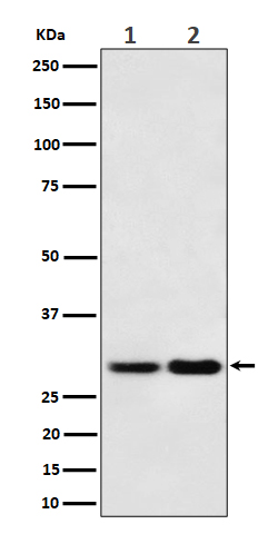 1 - Anti-MTAP Rabbit Monoclonal Antibody ABO16362