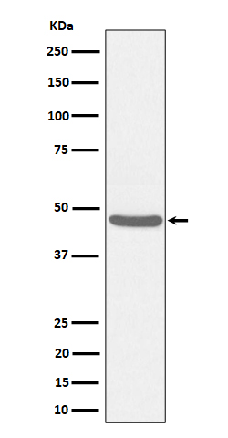 1 - Anti-BCKDK Rabbit Monoclonal Antibody ABO16365